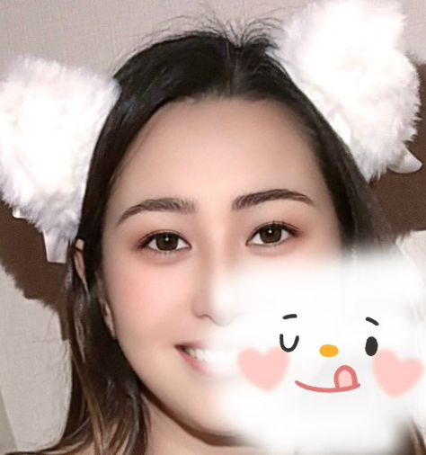 白月光
