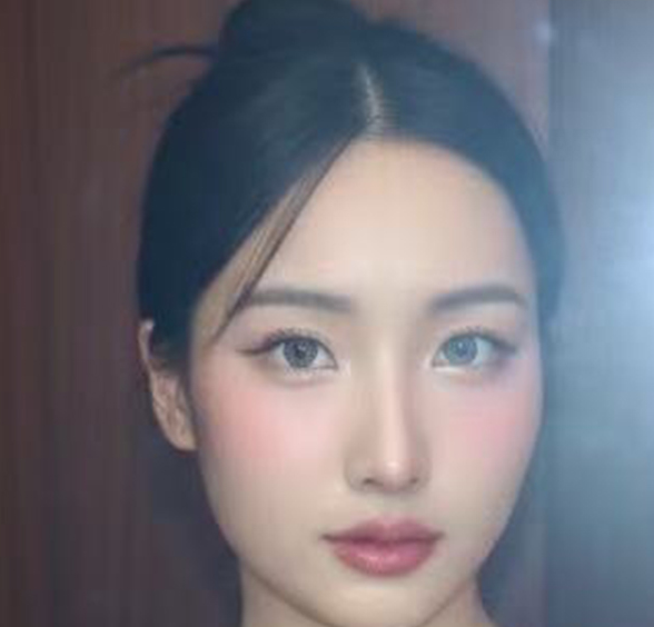 奇跡