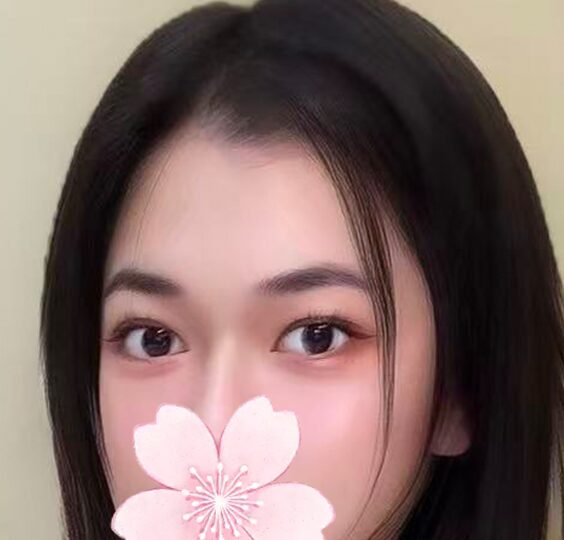 ダイアモンド