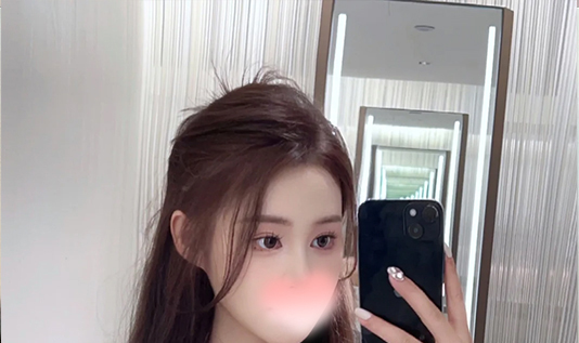 アルマ